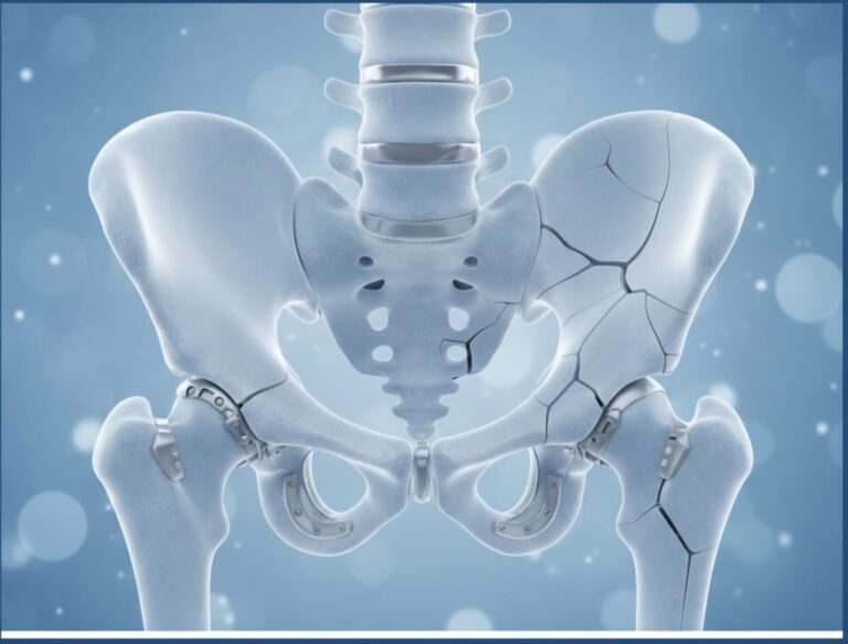 جراحات الحوض المعقدة